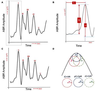 Detecting Cochlear Synaptopathy Through Curvature Quantification of the Auditory Brainstem Response